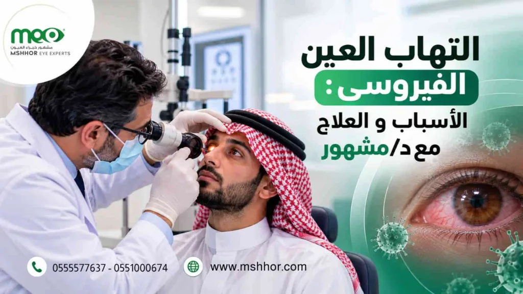 التهاب العين الفيروسي