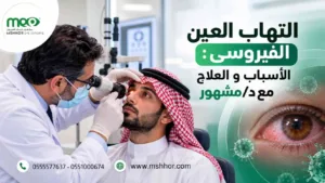 التهاب العين الفيروسي