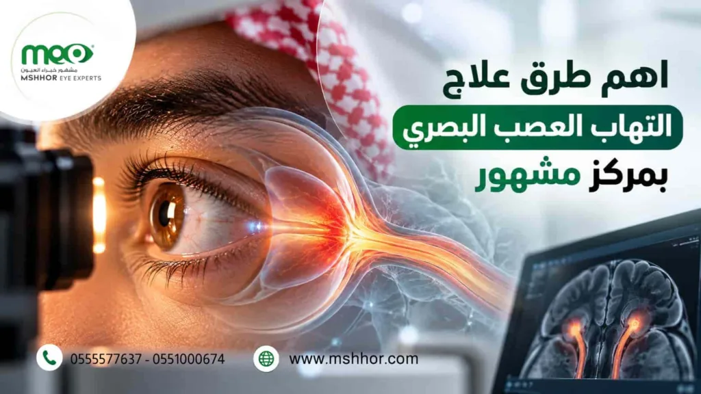 علاج التهاب العصب البصري