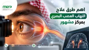 علاج التهاب العصب البصري
